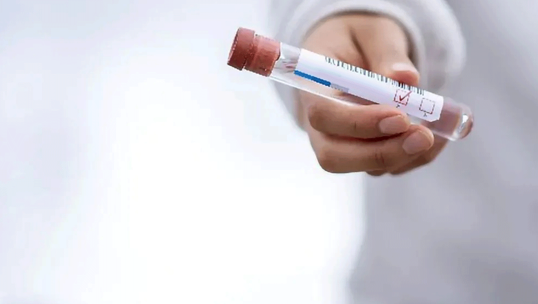 The Next level of swabs, is fast RNA testing